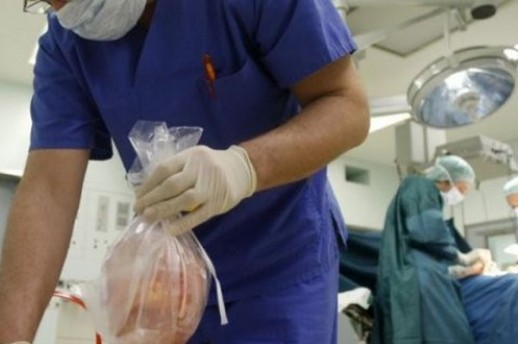 6697.transplantacija organa